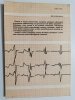 ZABURZENIA PRZEWODZENIA ŚRÓDKOMOROWEGO - Jerzy Kuch 1979